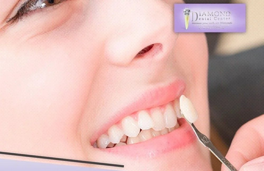 Diamond Dental Center