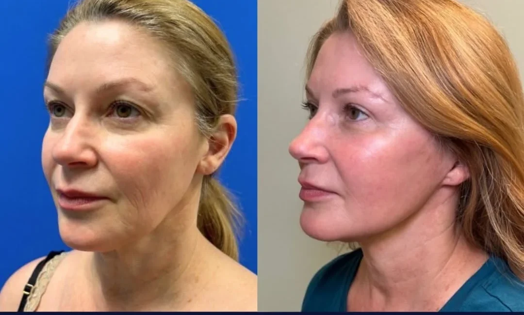 Dr. Alexandra Hart Plastic Surgery