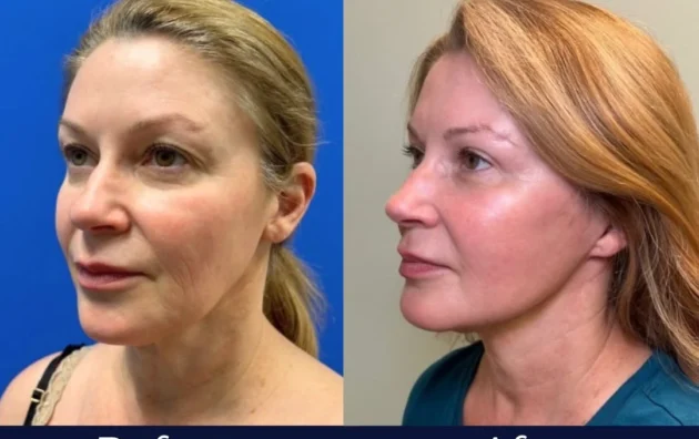 Dr. Alexandra Hart Plastic Surgery