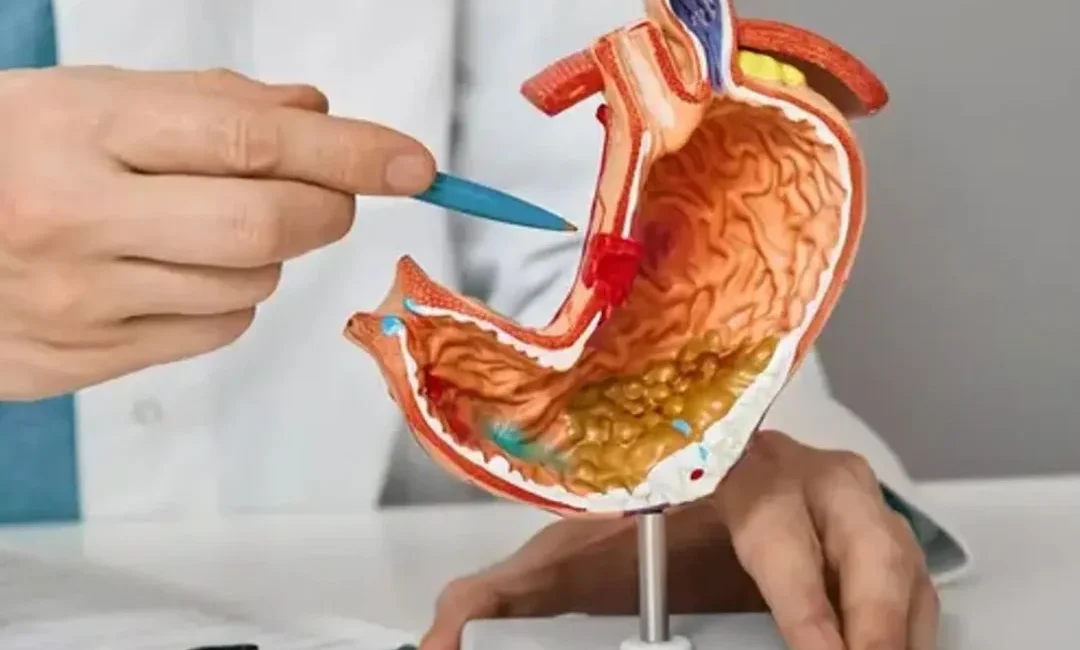 Stomach Cancer Treatment in India